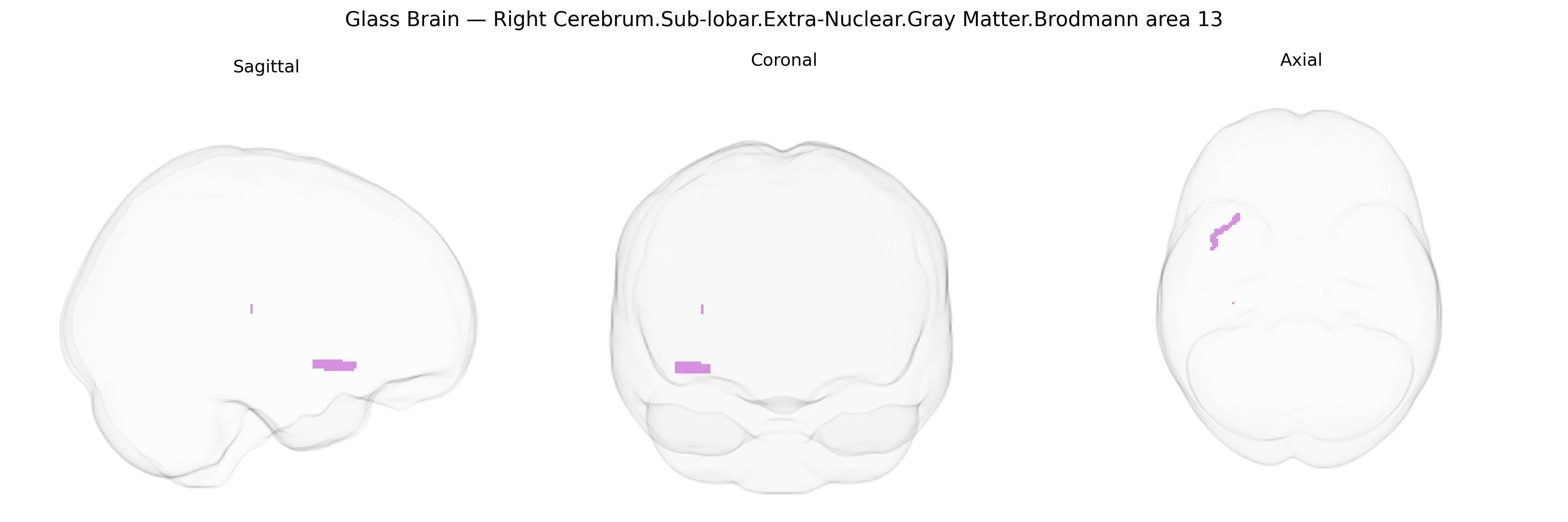 Triplanar Ghost Brain