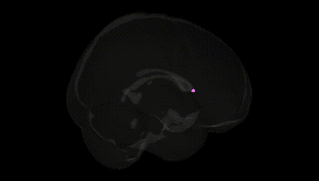 Full Brain Black