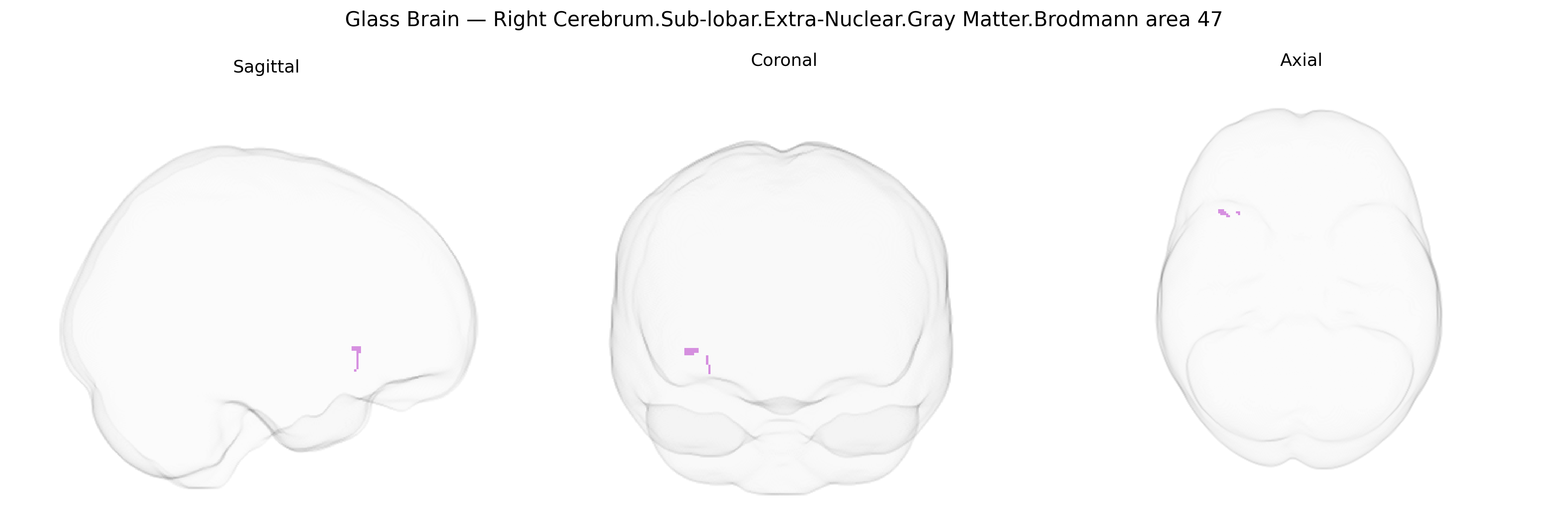 Triplanar Ghost Brain