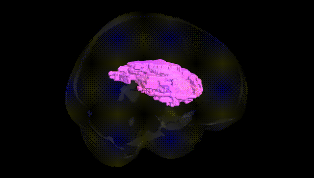 Full Brain Black