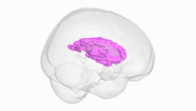 Full Brain White