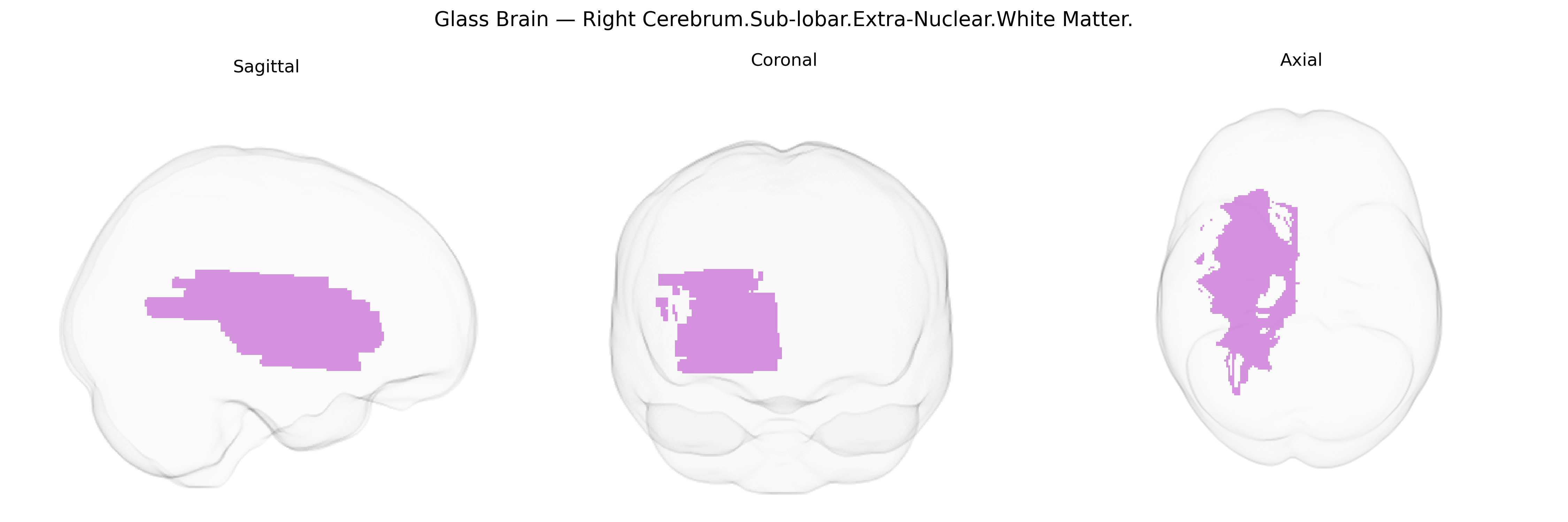 Triplanar Ghost Brain