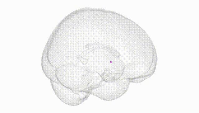 Full Brain White