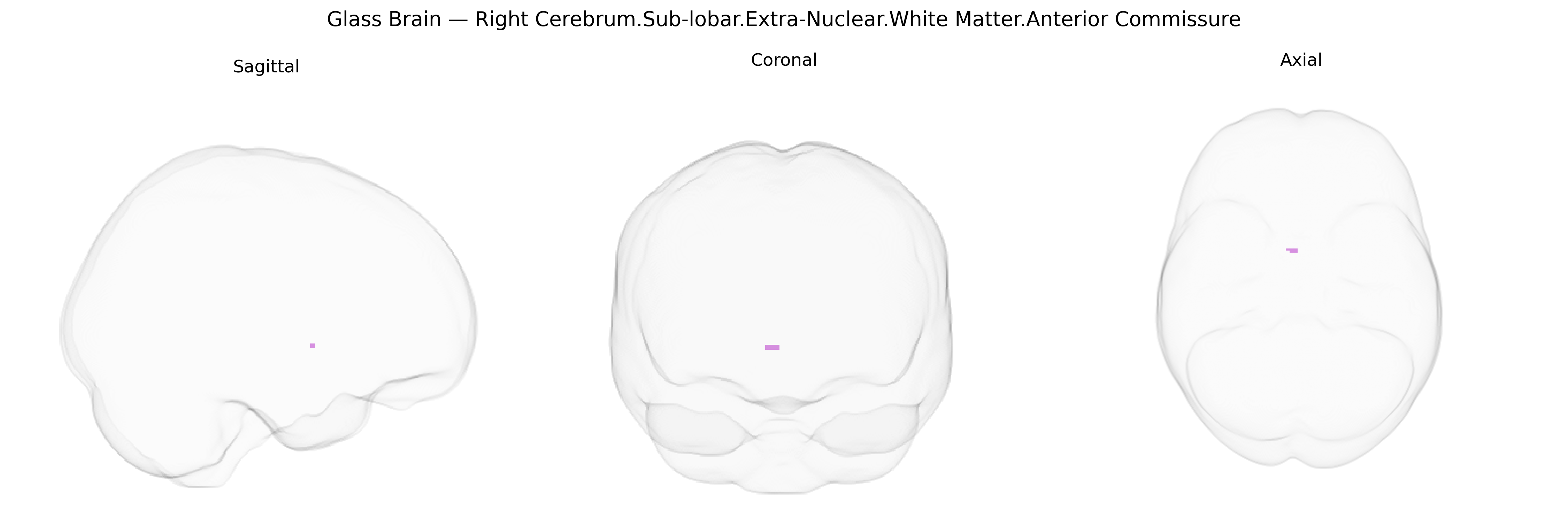Triplanar Ghost Brain