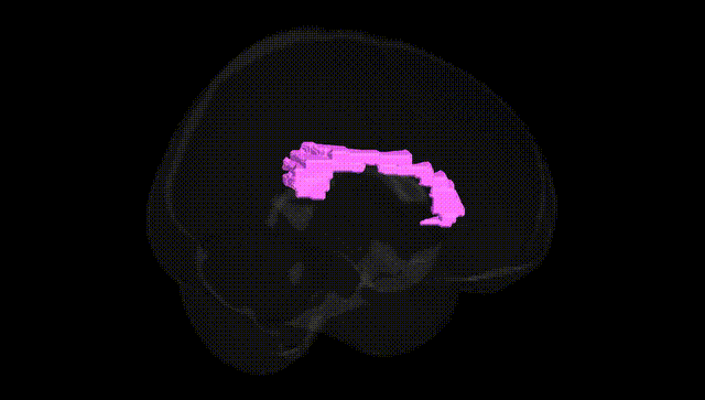 Full Brain Black