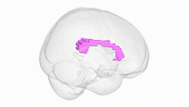 Full Brain White