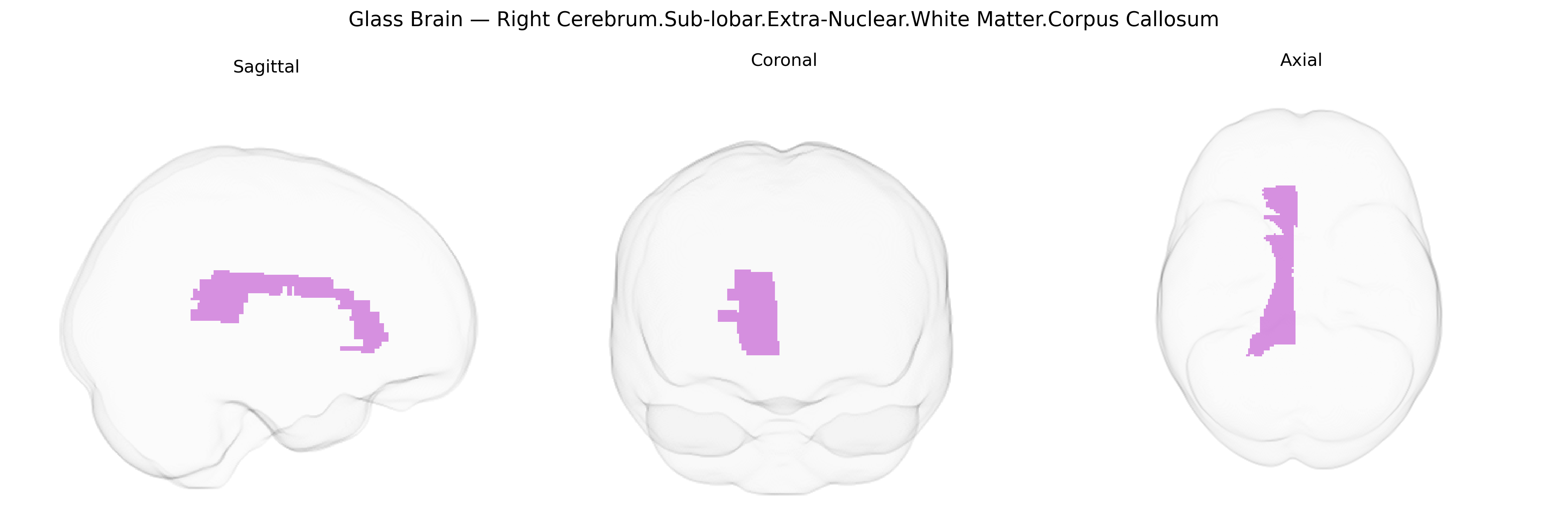 Triplanar Ghost Brain
