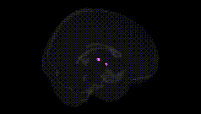 Full Brain Black