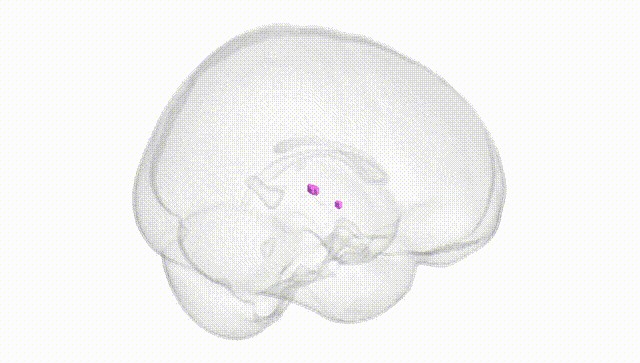 Full Brain White