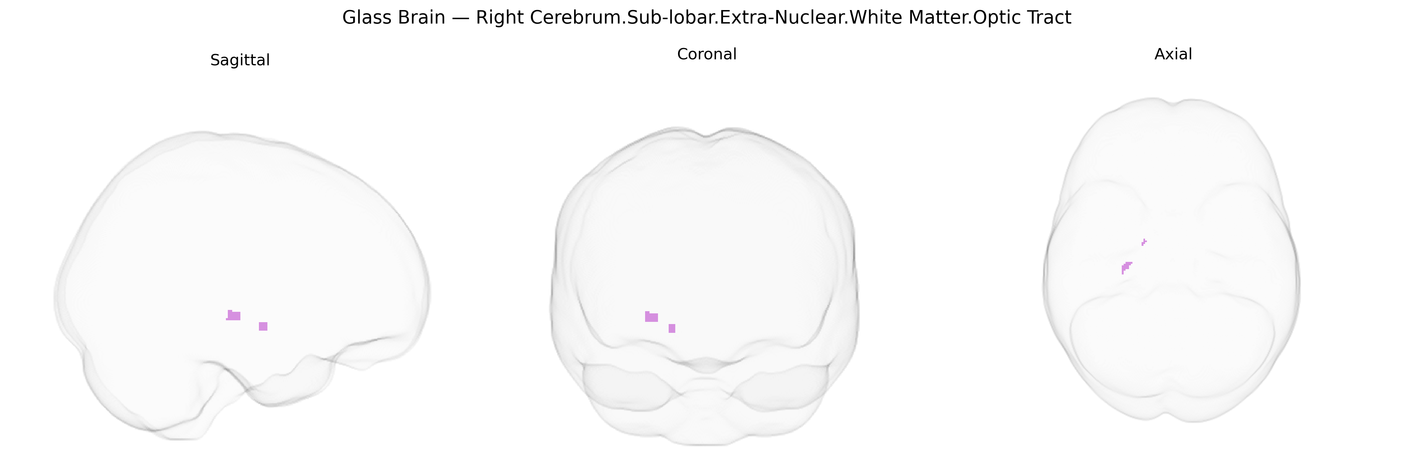 Triplanar Ghost Brain