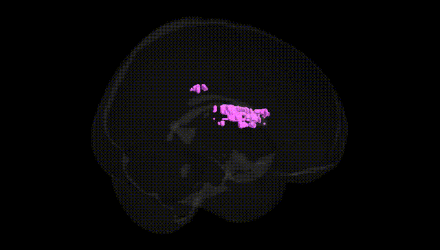 Full Brain Black