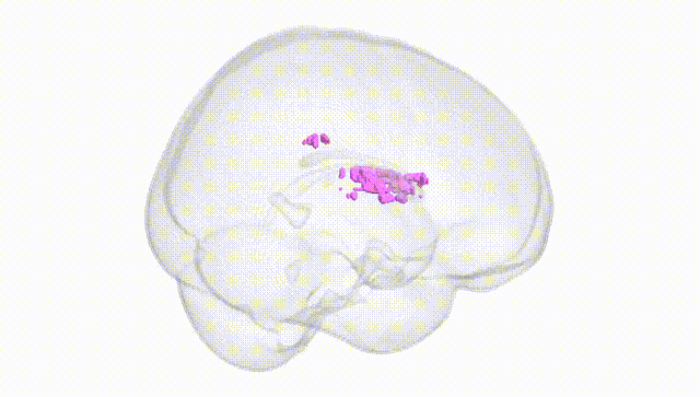 Full Brain White