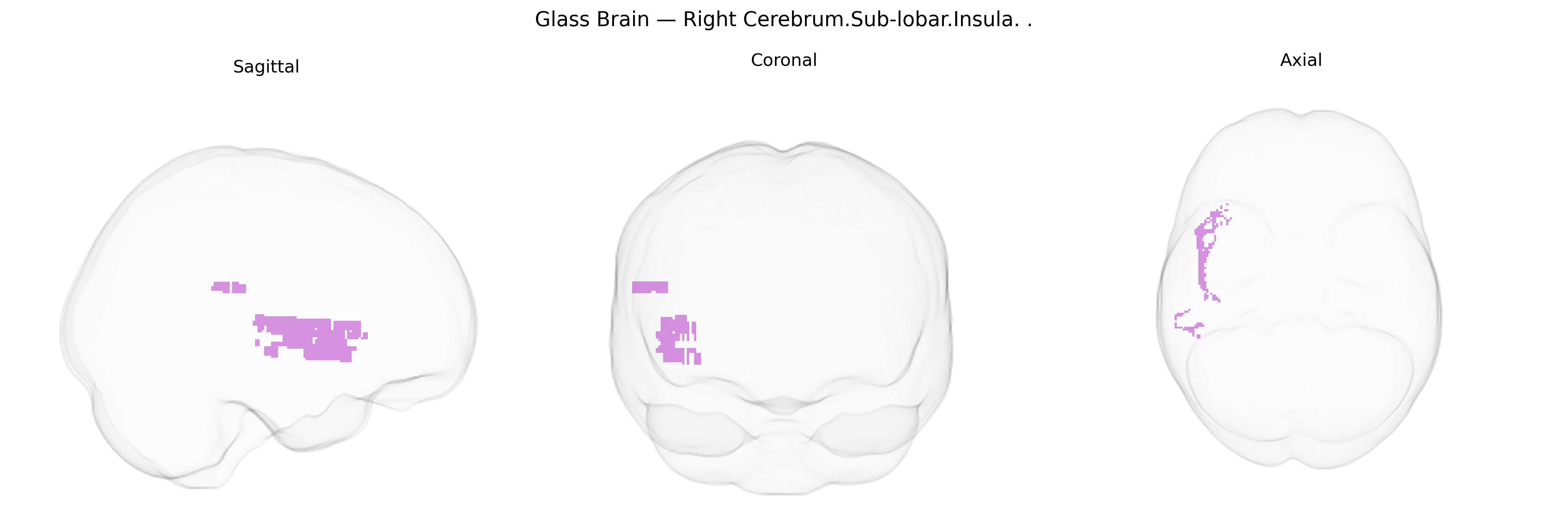Triplanar Ghost Brain