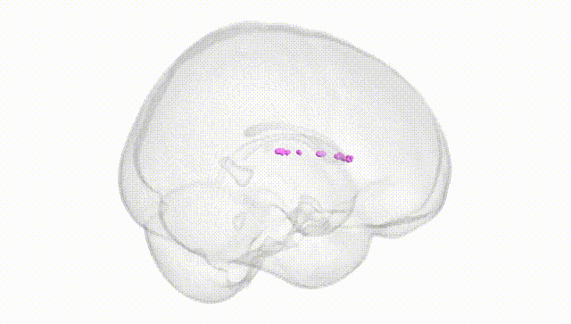 Full Brain White