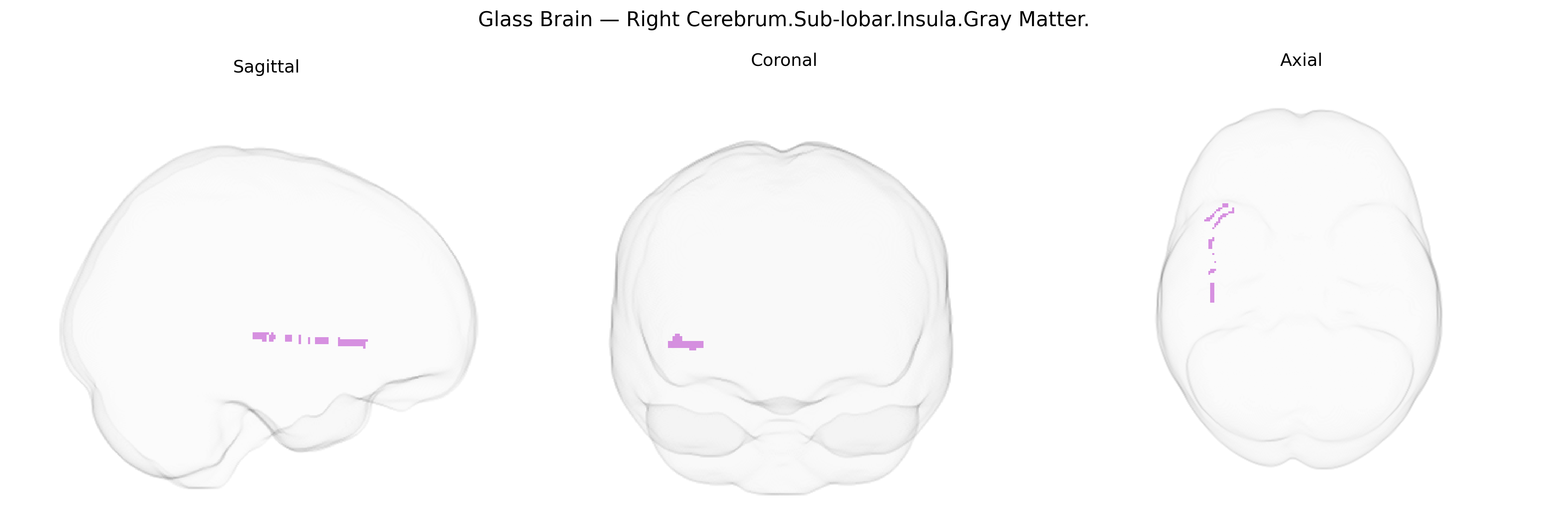 Triplanar Ghost Brain