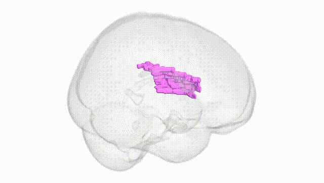 Full Brain White