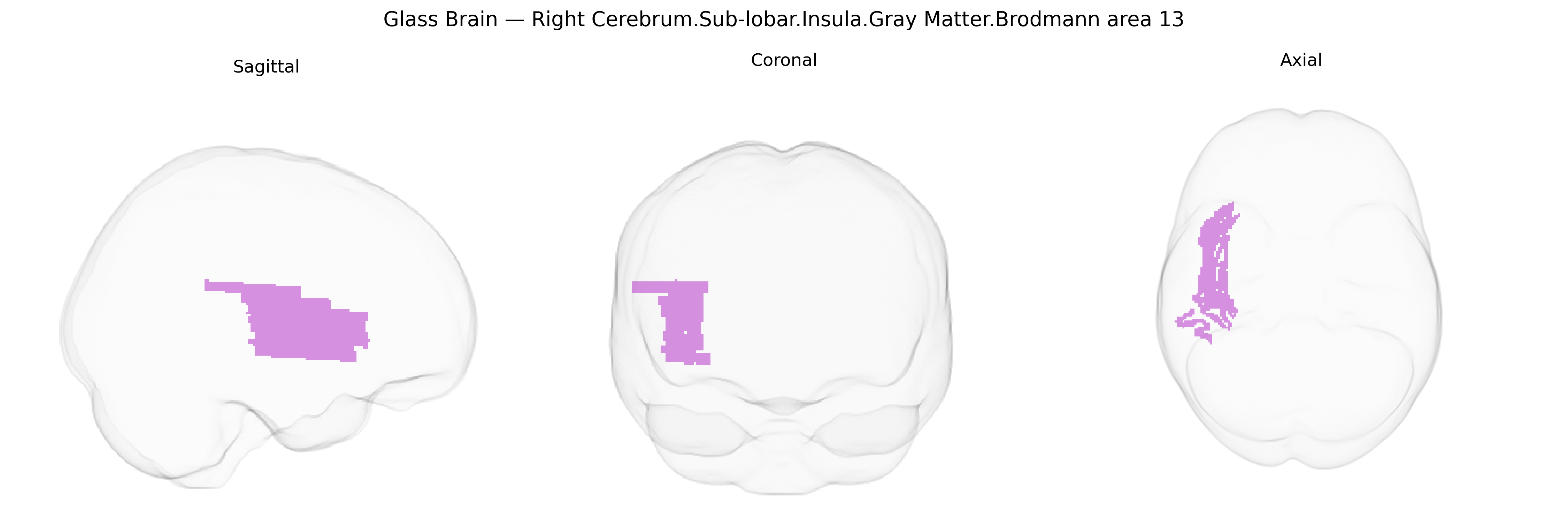 Triplanar Ghost Brain