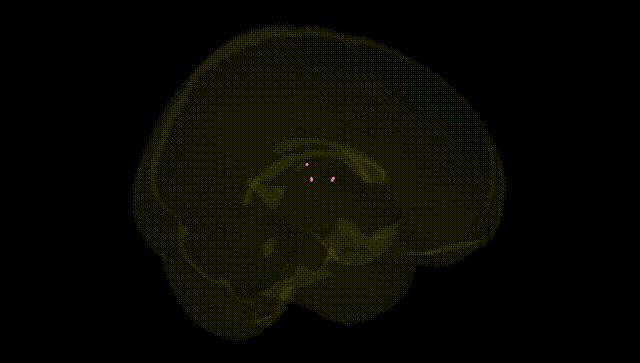 Full Brain Black