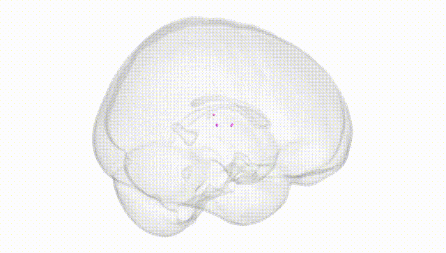 Full Brain White