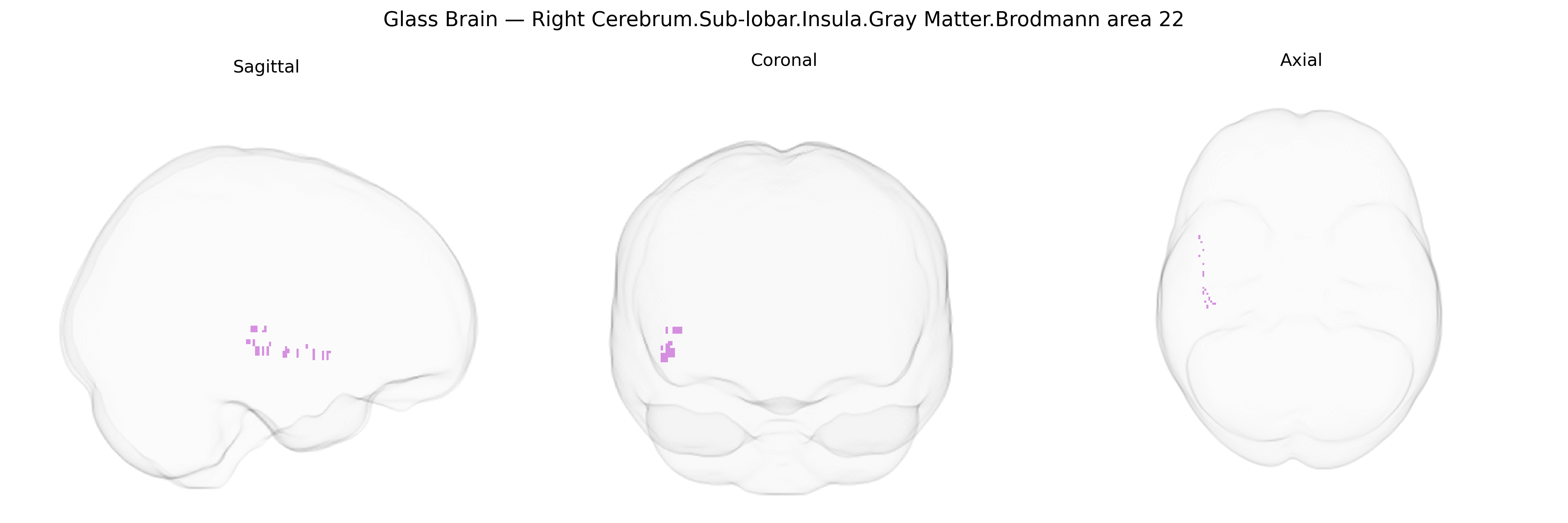 Triplanar Ghost Brain