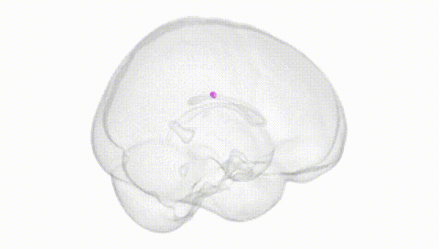 Full Brain White