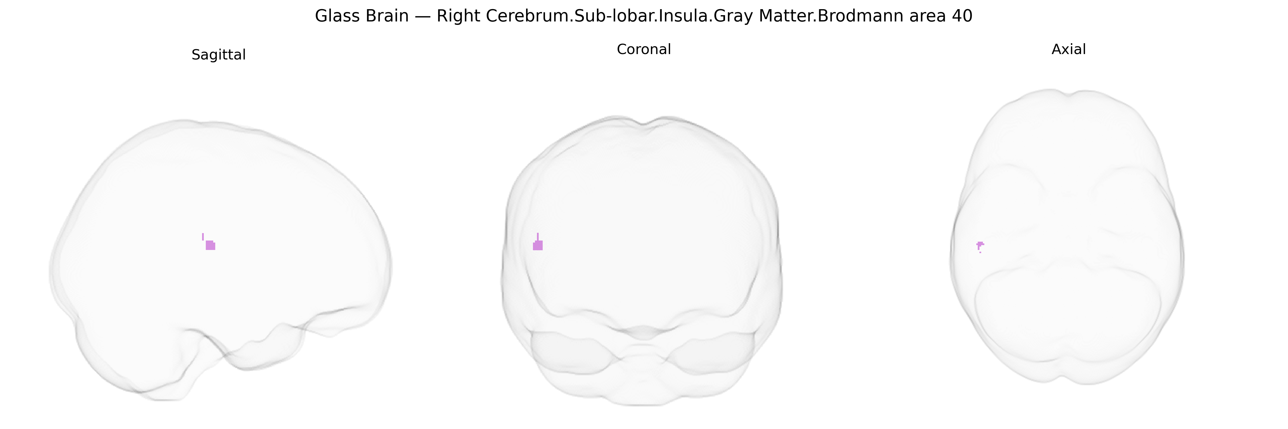 Triplanar Ghost Brain
