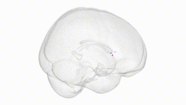 Full Brain White