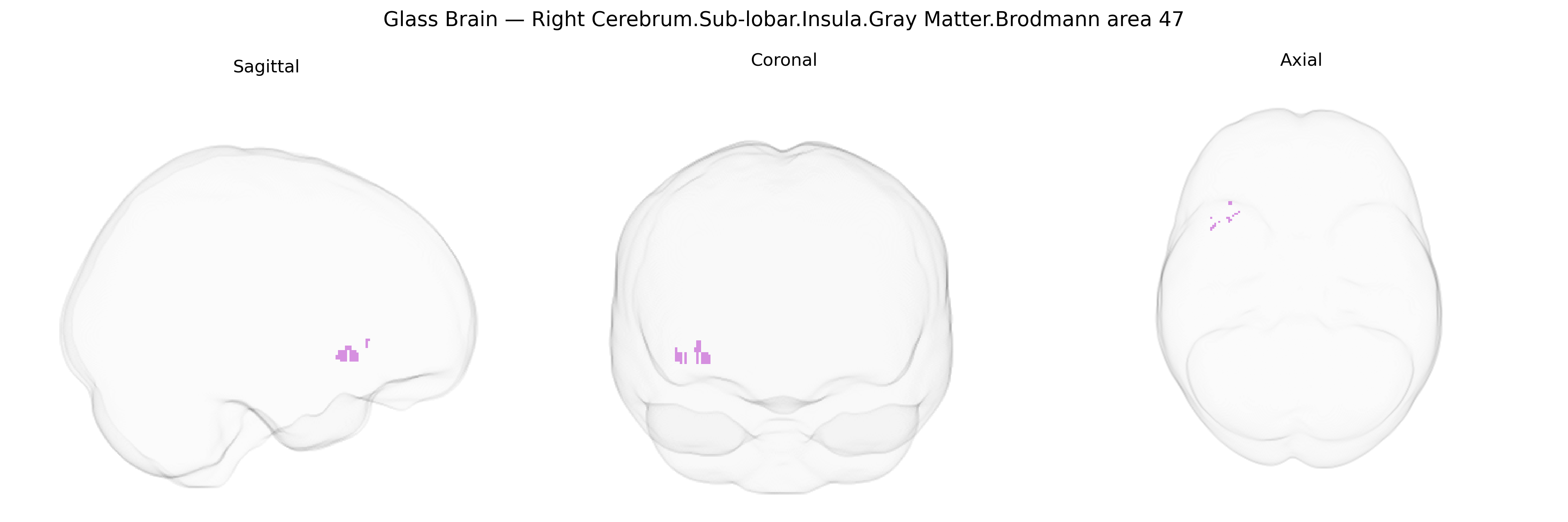 Triplanar Ghost Brain