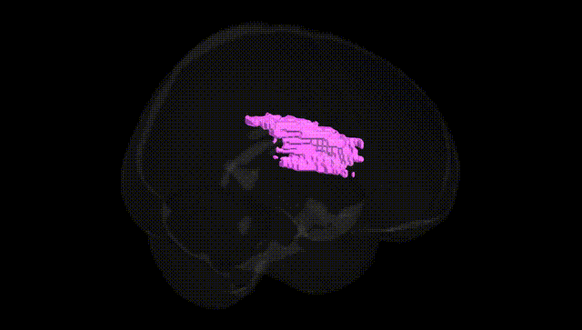 Full Brain Black