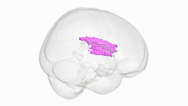 Full Brain White