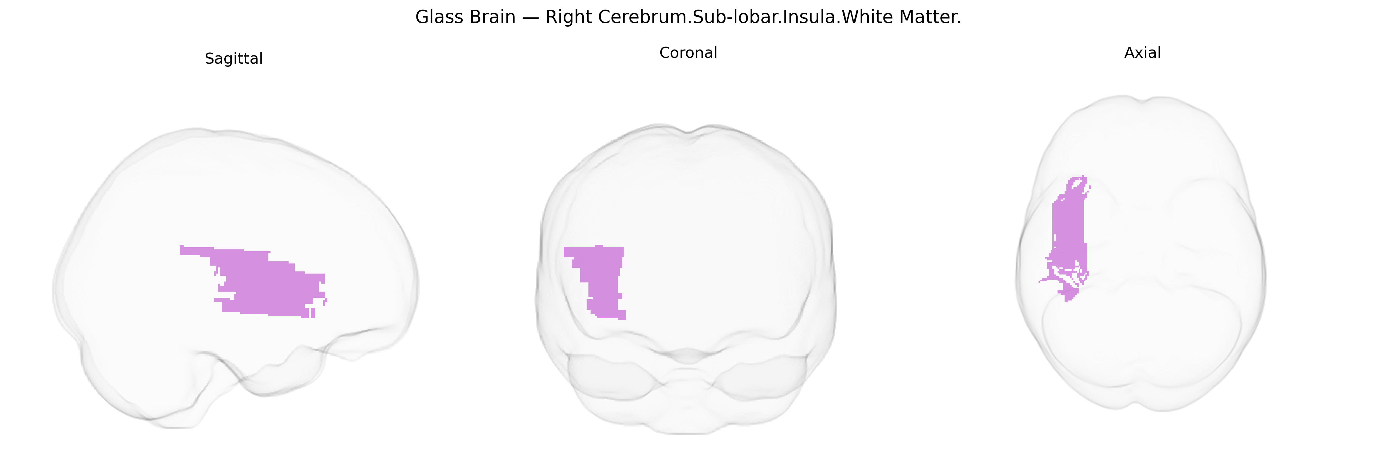 Triplanar Ghost Brain