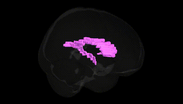 Full Brain Black
