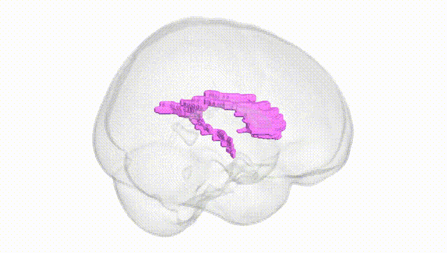 Full Brain White
