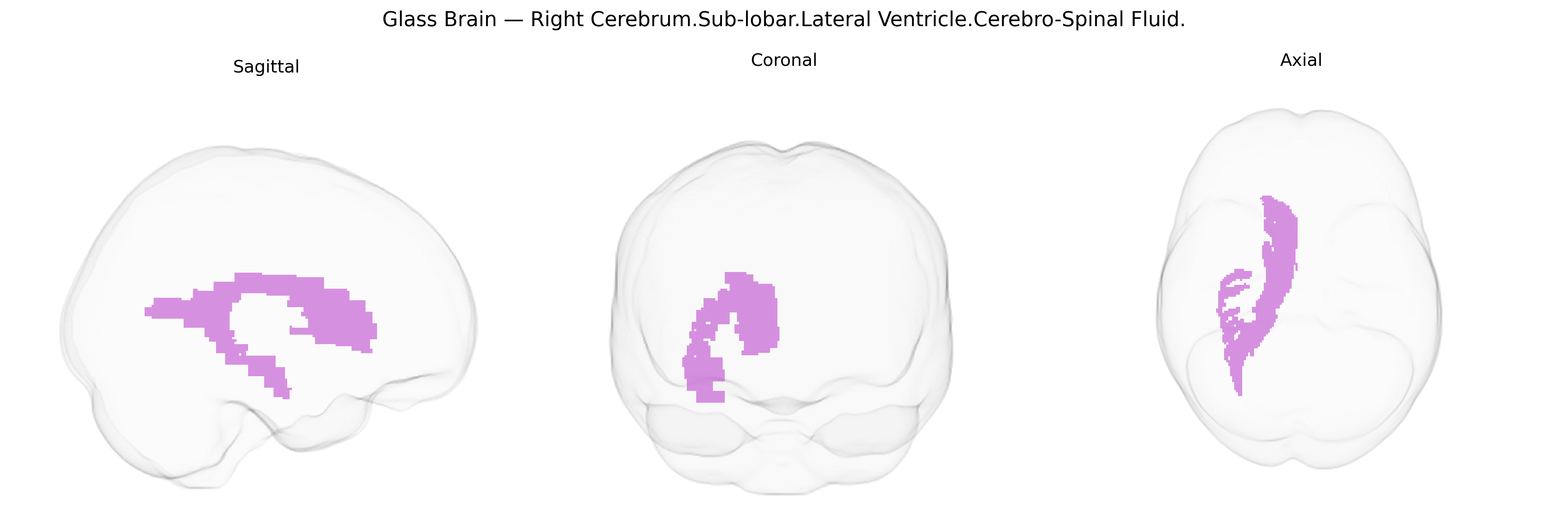 Triplanar Ghost Brain
