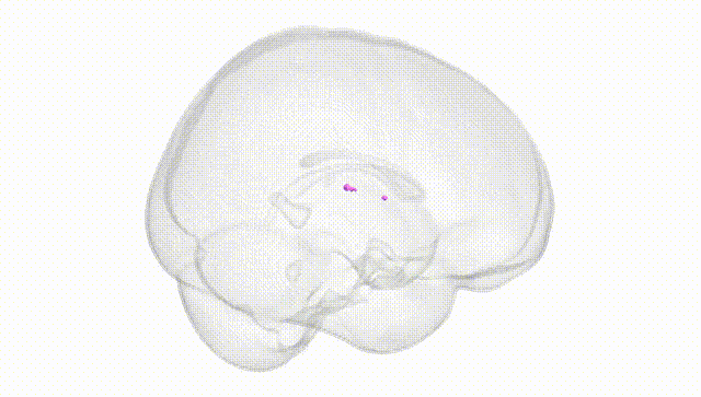 Full Brain White