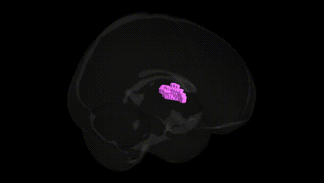 Full Brain Black