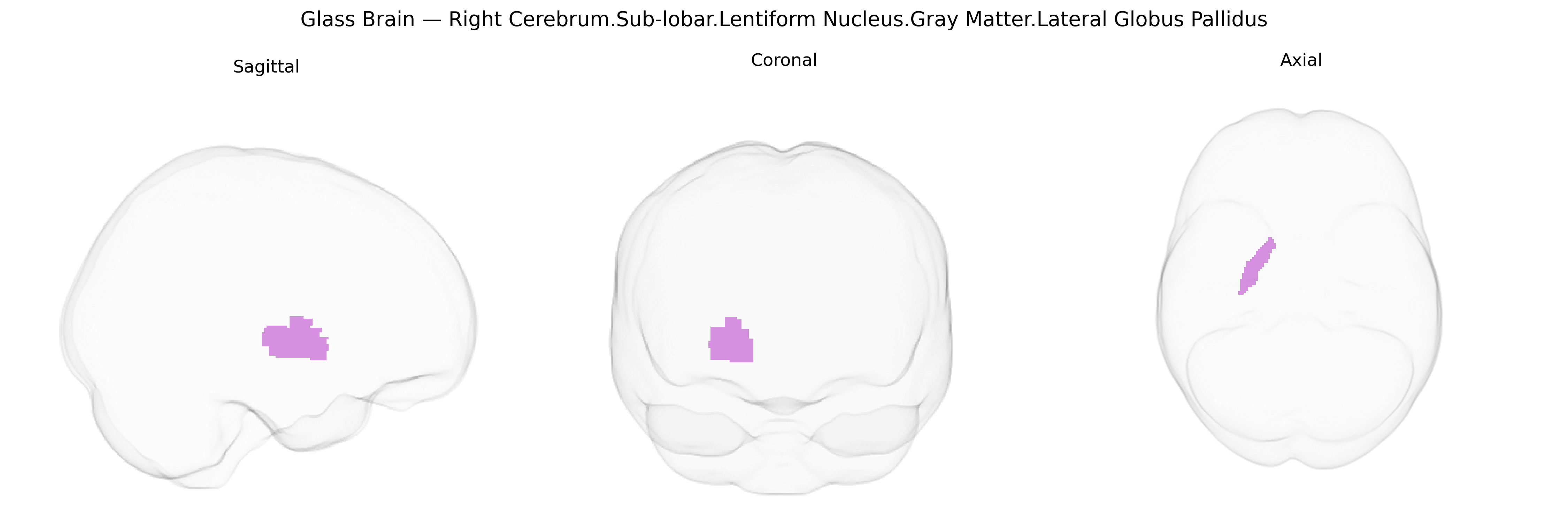 Triplanar Ghost Brain