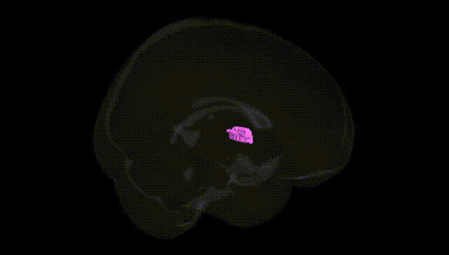 Full Brain Black
