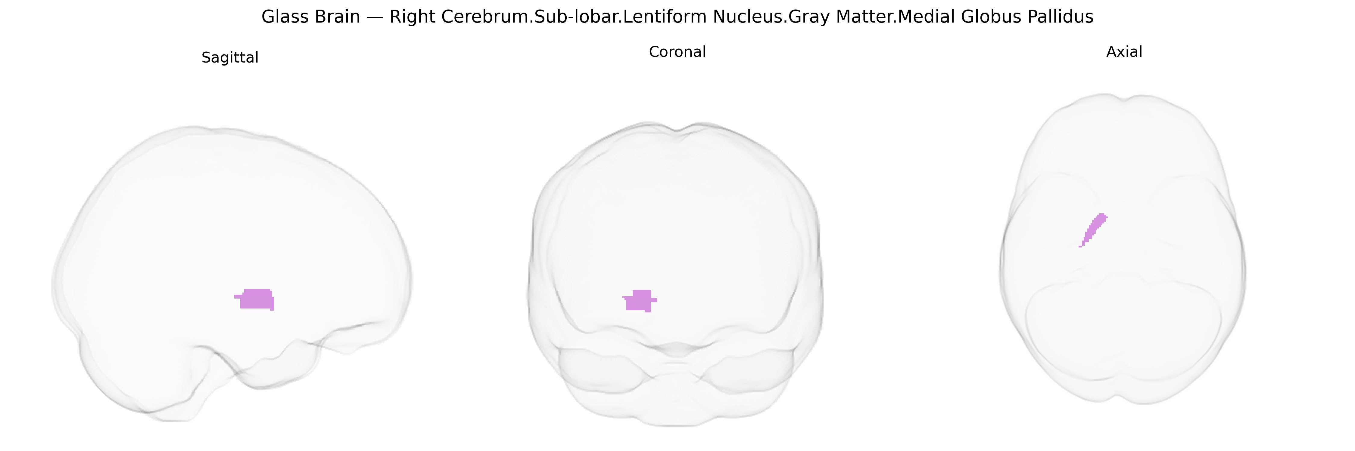 Triplanar Ghost Brain
