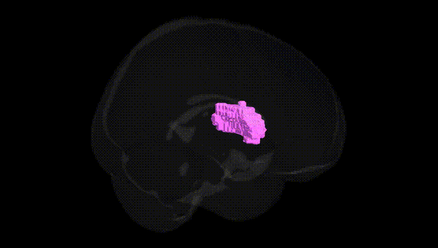 Full Brain Black