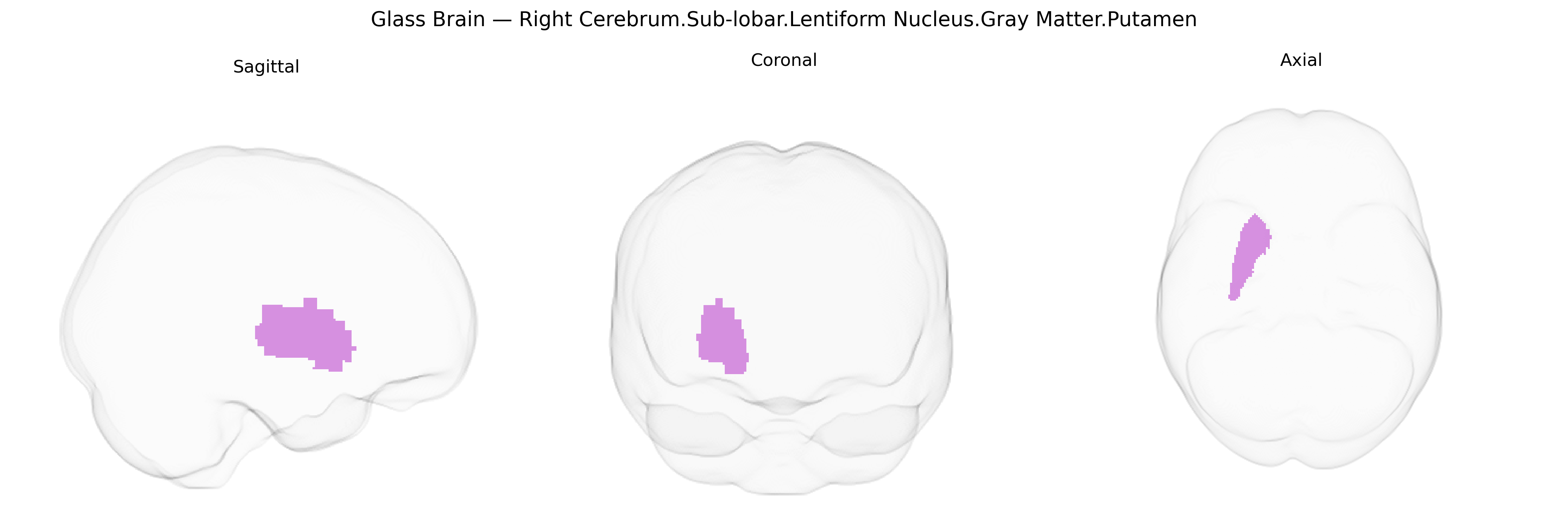 Triplanar Ghost Brain