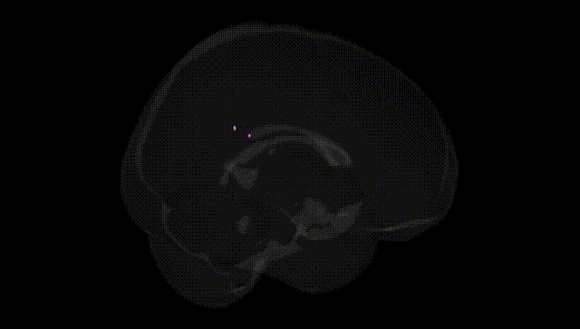 Full Brain Black
