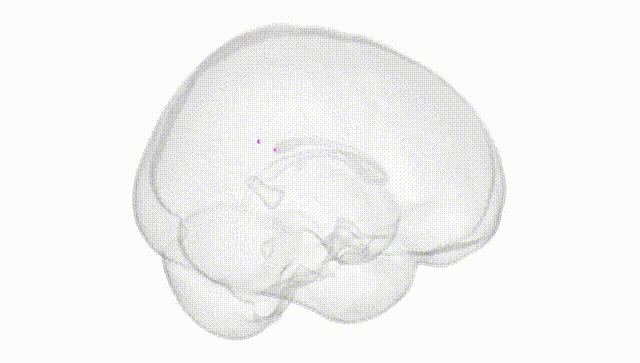 Full Brain White