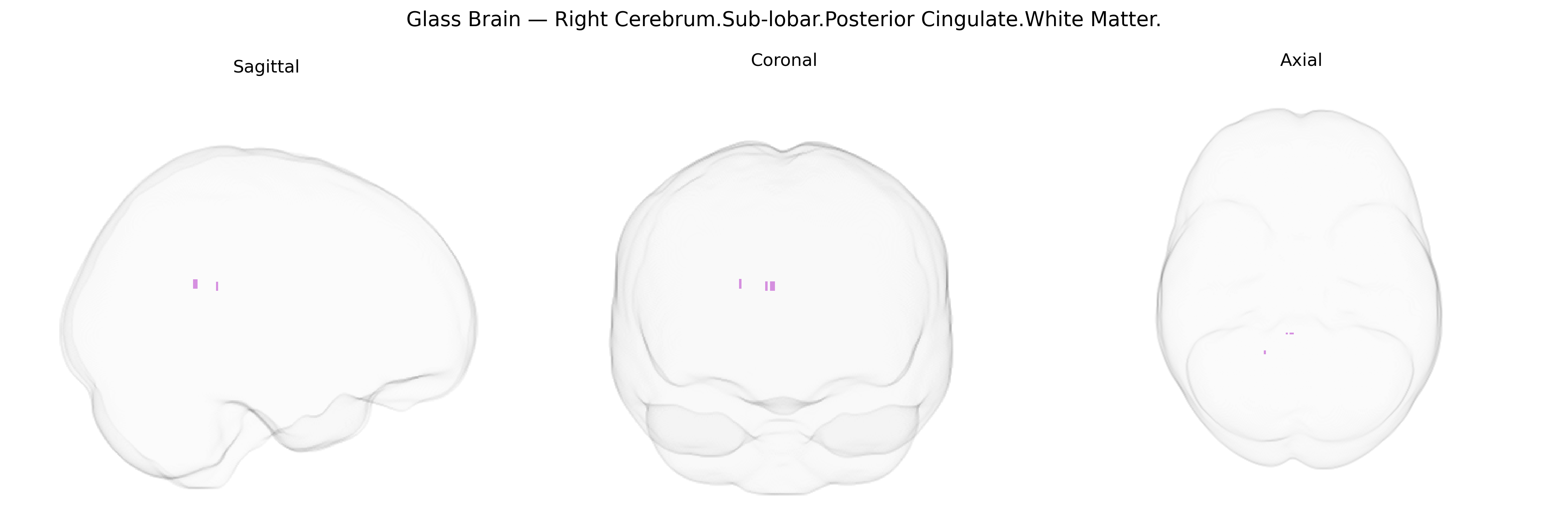Triplanar Ghost Brain