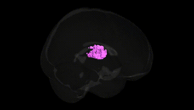 Full Brain Black