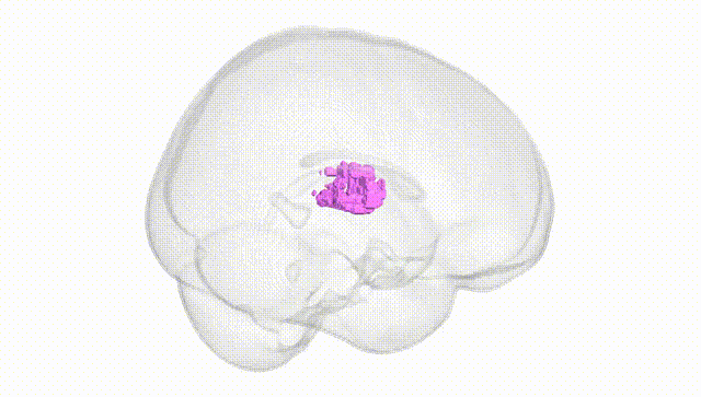 Full Brain White