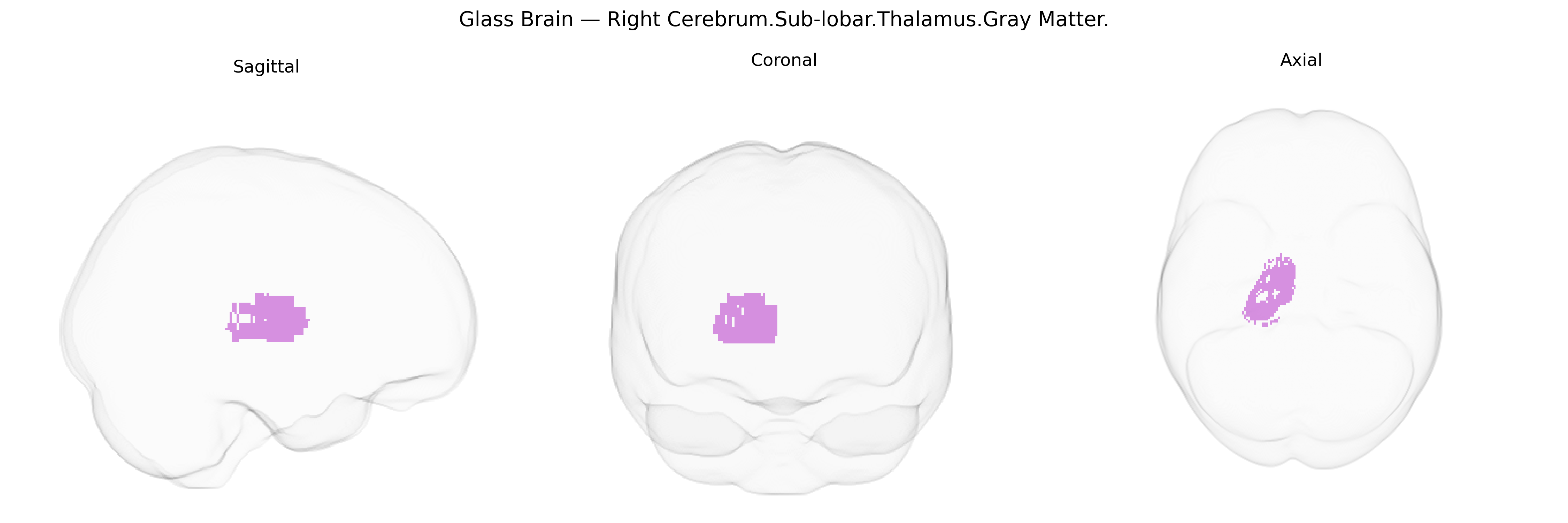 Triplanar Ghost Brain