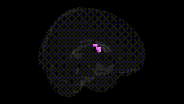 Full Brain Black