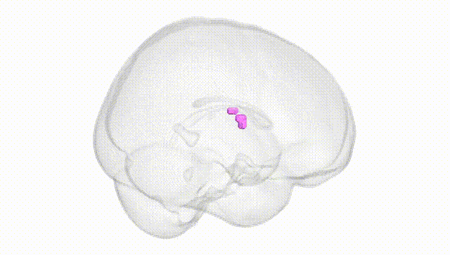 Full Brain White