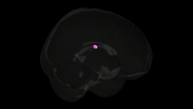 Full Brain Black